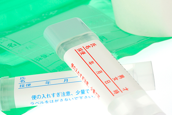 ピロリ菌検査の方法